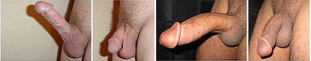 penises
